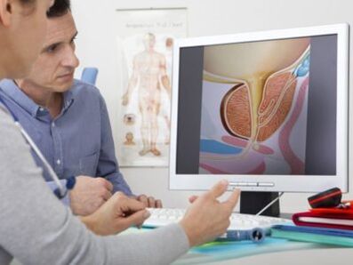 A urologist consults a patient about potency problems.